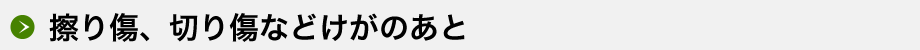 擦り傷、切り傷などけがのあと