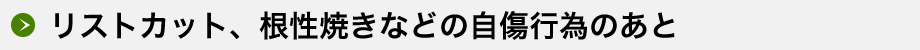 リストカット、根性焼きなどの自傷行為のあと