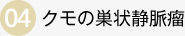 クモの巣状静脈瘤