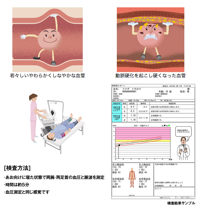 B血管年齢検査_r2_c2