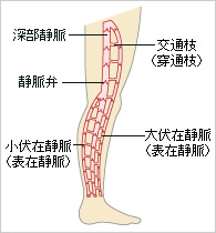 下肢静脈瘤ではありませんか 東京血管外科クリニック