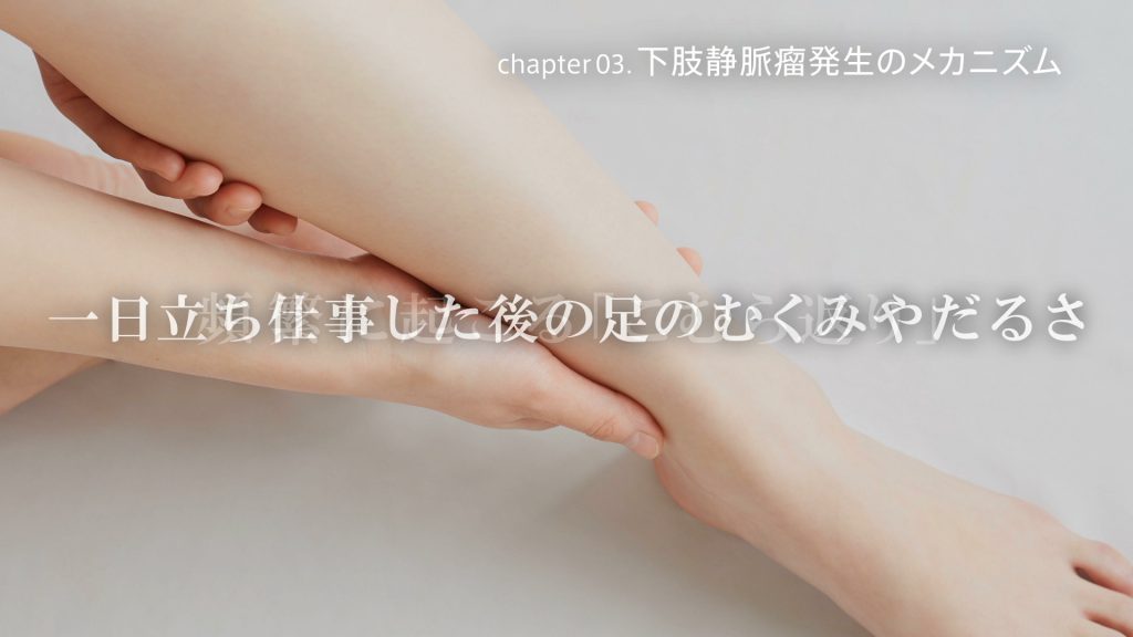 下肢静脈瘤ではありませんか 東京血管外科クリニック