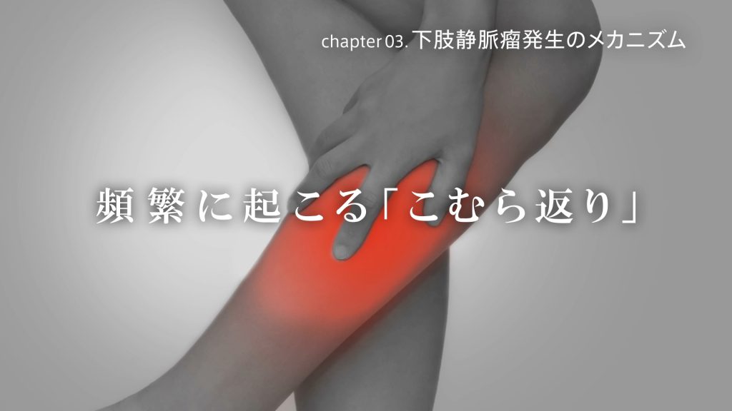 下肢静脈瘤ではありませんか 東京血管外科クリニック