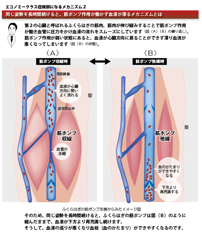 症候群 エコノミー 症状 クラス エコノミークラス症候群の症状